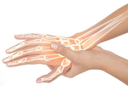 Hondrox kantakse kahjustatud alale