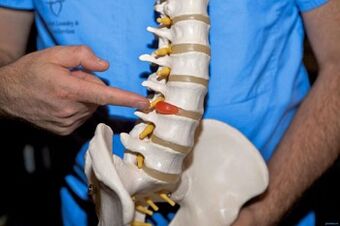 Miks selg valutab alaselja ja mida teha