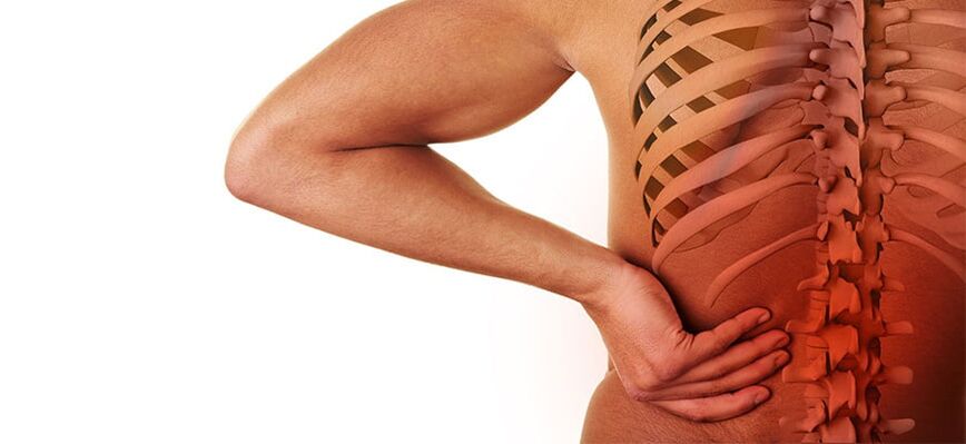 nimmepiirkonna osteokondroosi sümptomid